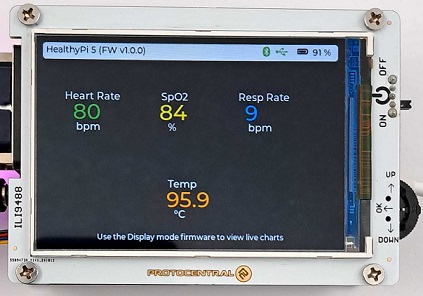 basic display FW to stream vitals